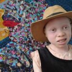 Gwen_cardi_Albinism_zim_2023
